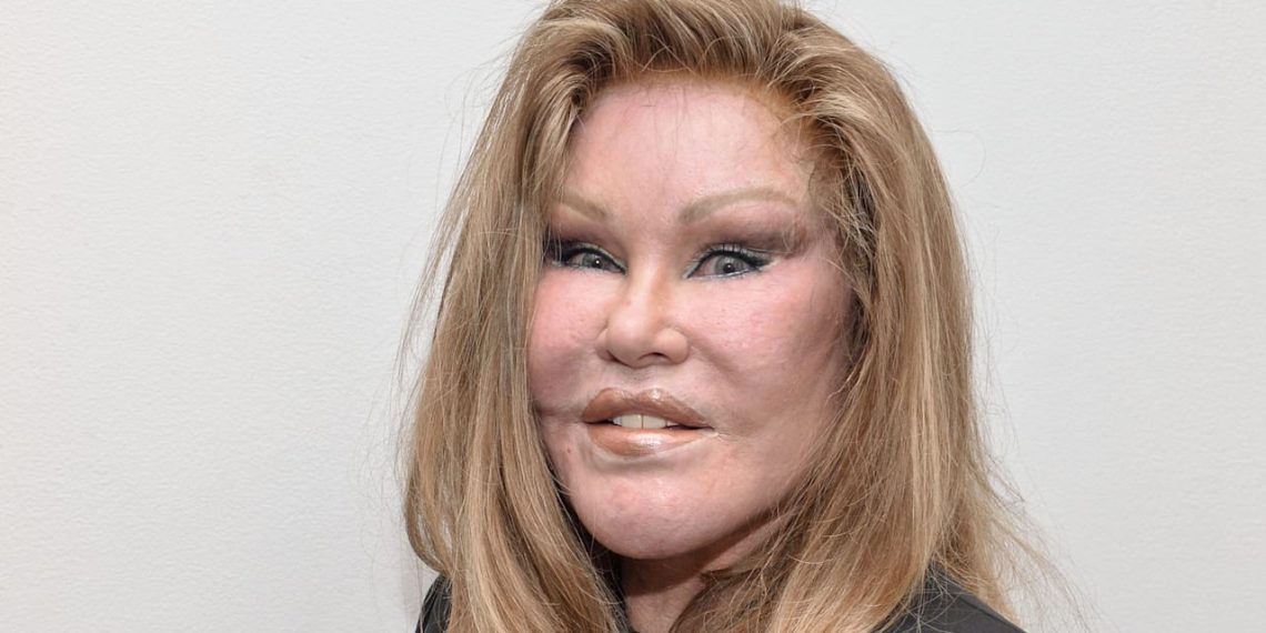 Katzenfrau Jocelyne Wildenstein ist tot | Unterhaltung