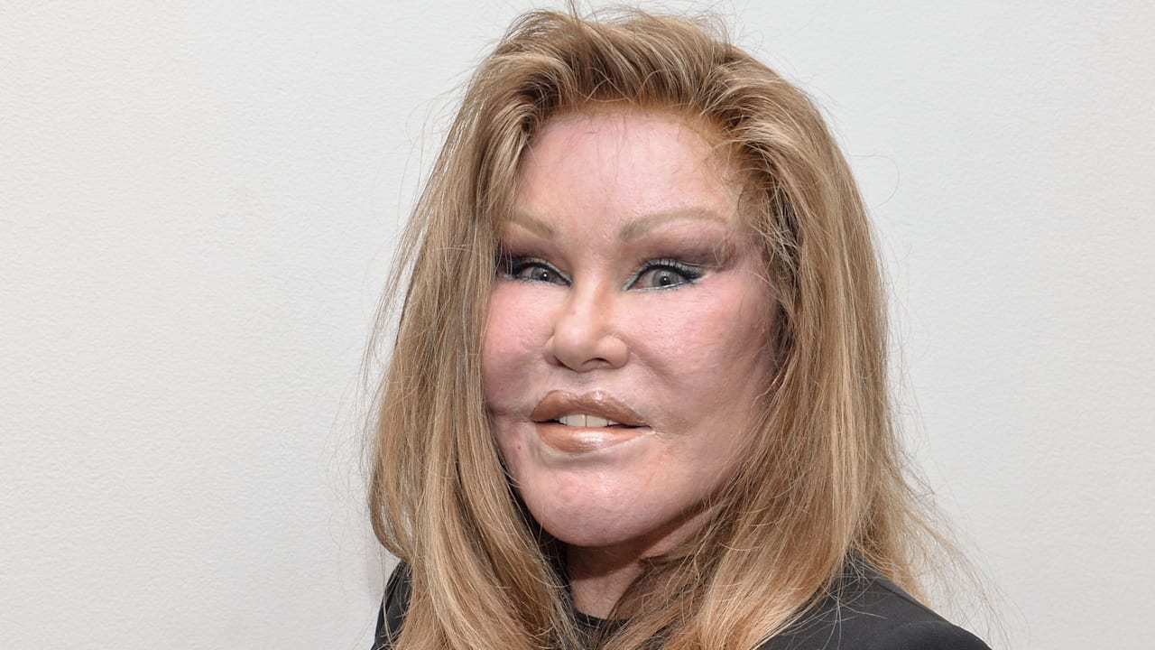 Katzenfrau Jocelyne Wildenstein ist tot | Unterhaltung