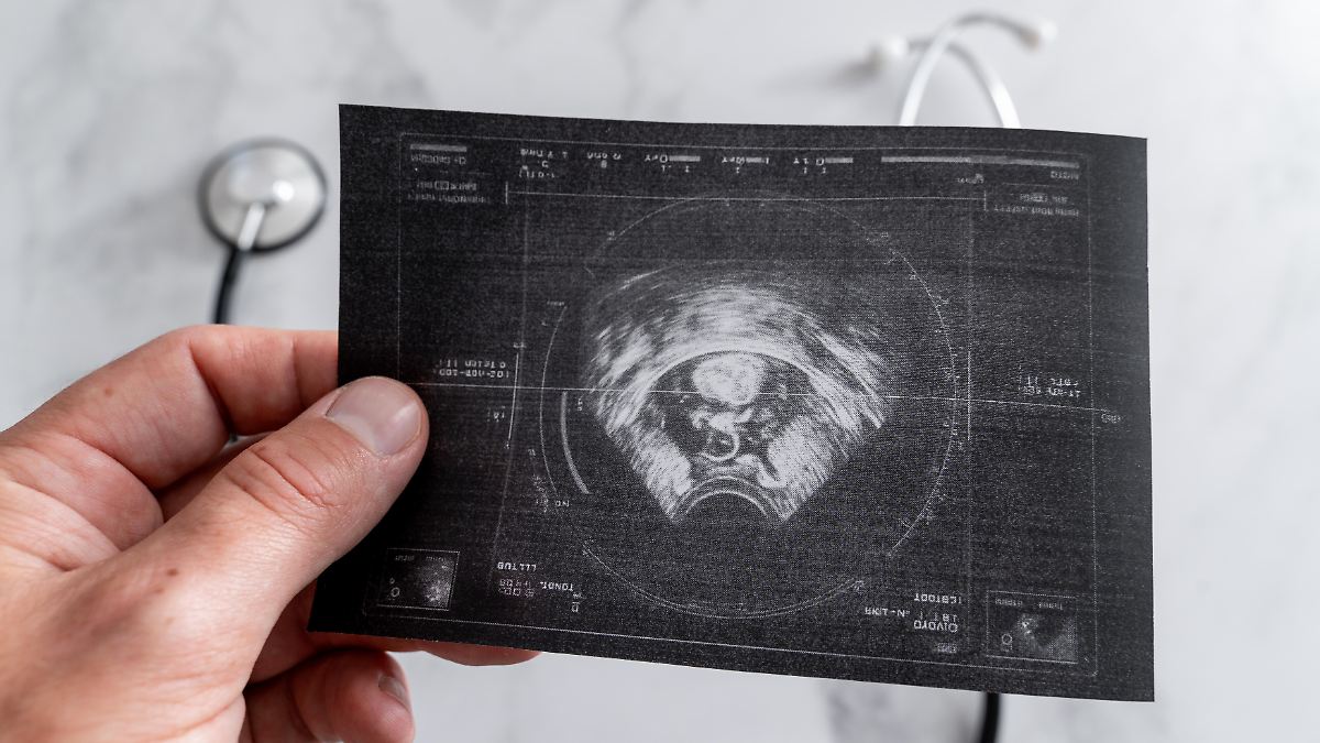 USA: Tot nach Angriff auf Drogenboot – N-TV