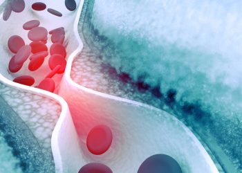 „Dieses Medikament senkt den Cholesterinspiegel viel besser als Statine“