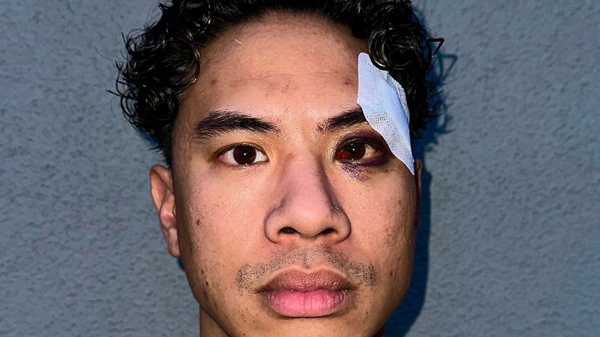 „Das war purer Rassismus“: Comedian Tutty Tran geschlagen und beleidigt